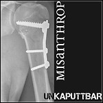 Misanthrop - Unkaputtbar Misanthrop - Unkaputtbar