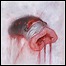 American Heritage - Prolapse American Heritage - Prolapse